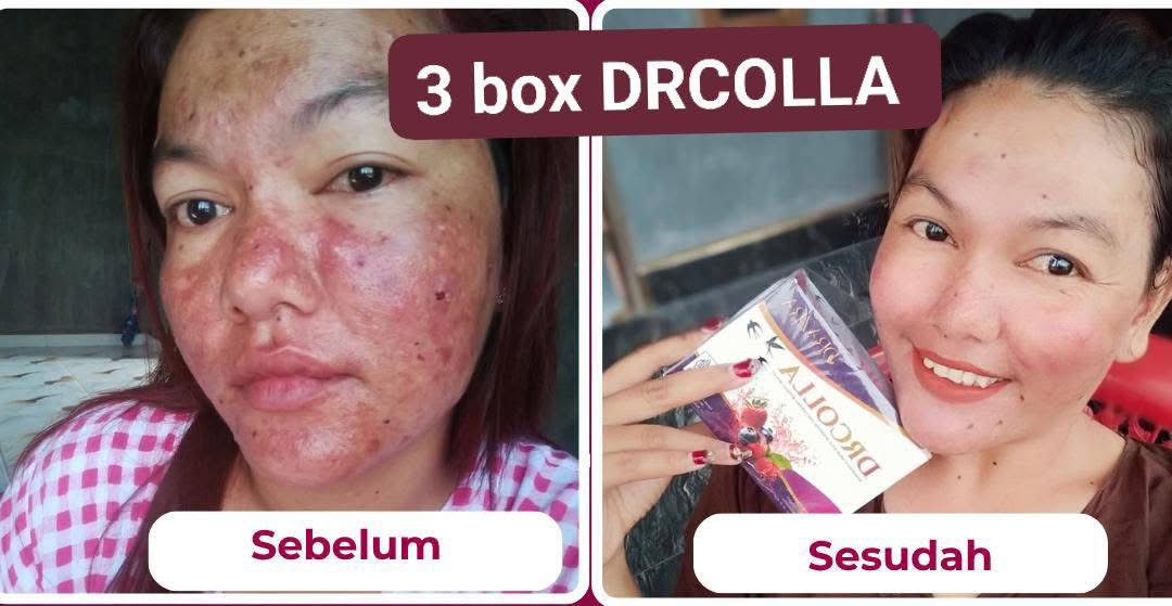 Testimoni tiga box DRCOLLA